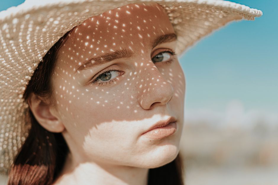 Femme visage taches soleil peau pigmentation été